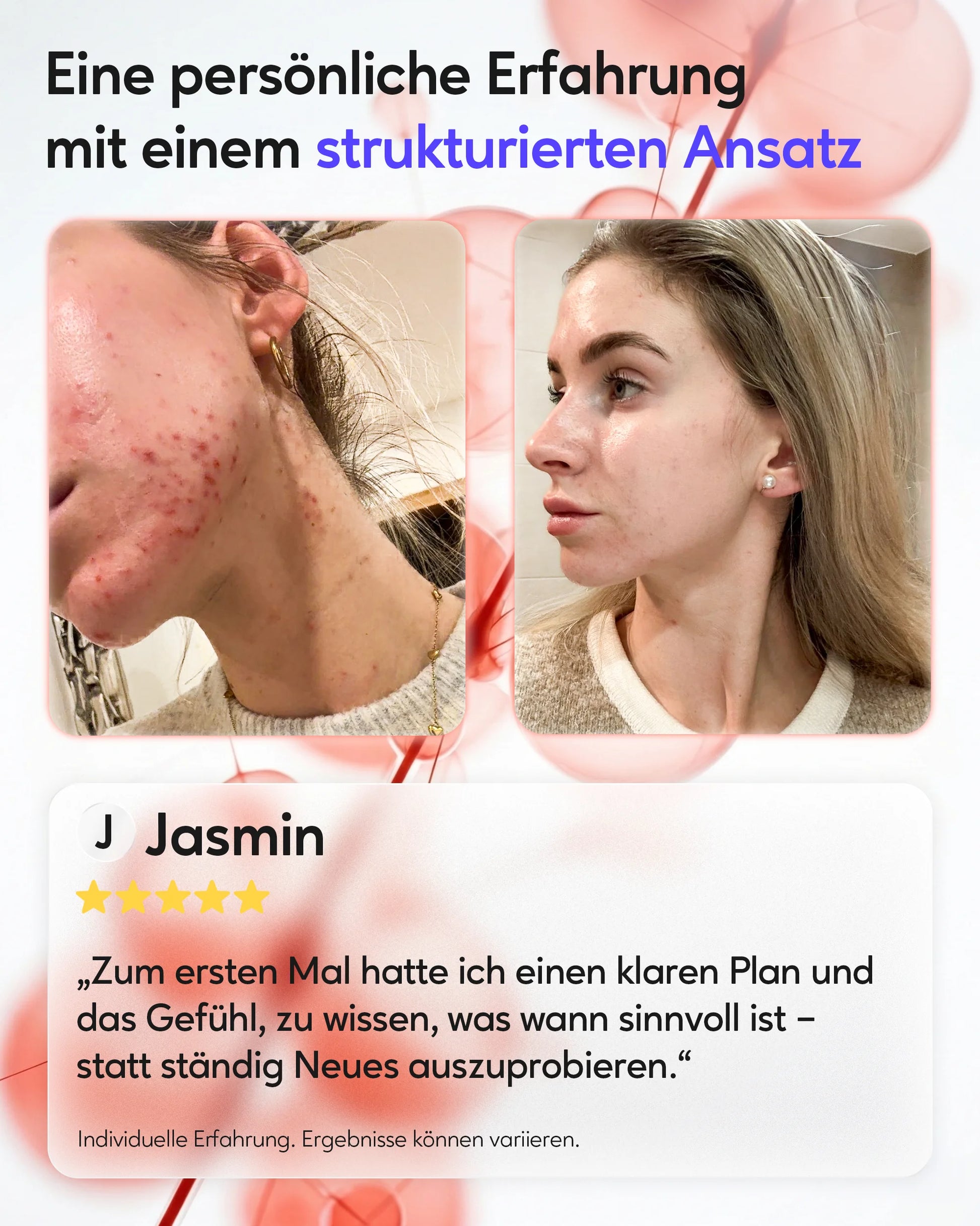 Hautbild nach dem 90-Tage-Protokoll von healthAesthetics+ – phasenbasierte innere Unterstützung
